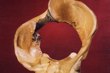 Bekken Pelvis