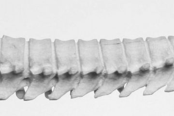 spine